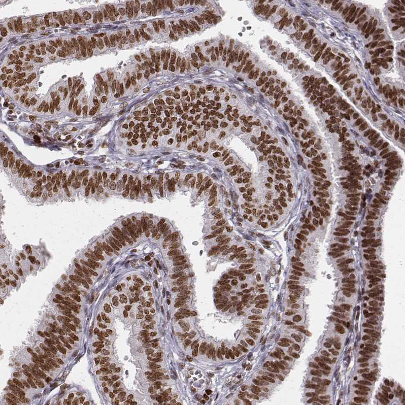 PARP Antibody (CL2220) - Azide and BSA Free Immunohistochemistry-Paraffin: PARP Antibody [NBP3-44461]