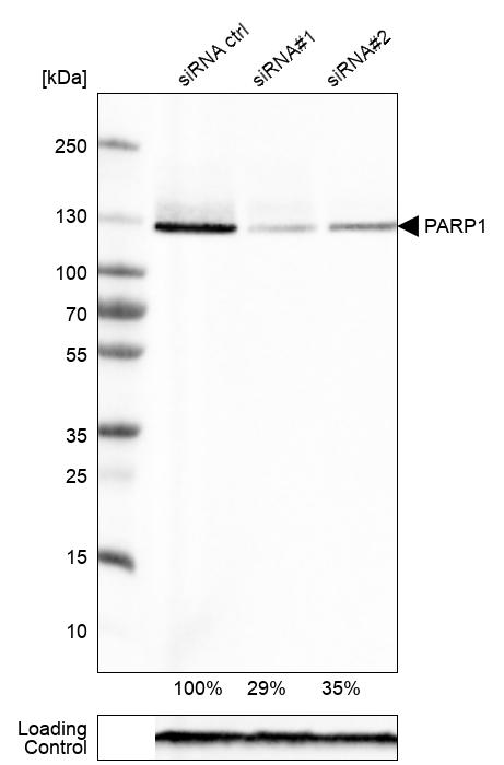 PARP Antibody (CL2220) - Azide and BSA Free Western Blot: PARP Antibody [NBP3-44461]