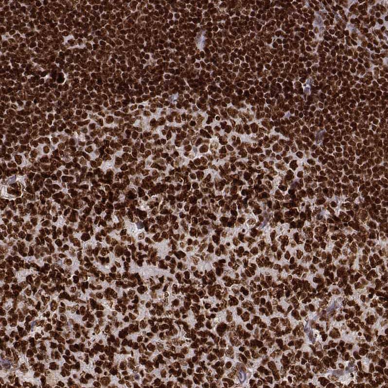 PARP Antibody (CL2220) - Azide and BSA Free Immunohistochemistry-Paraffin: PARP Antibody [NBP3-44461]