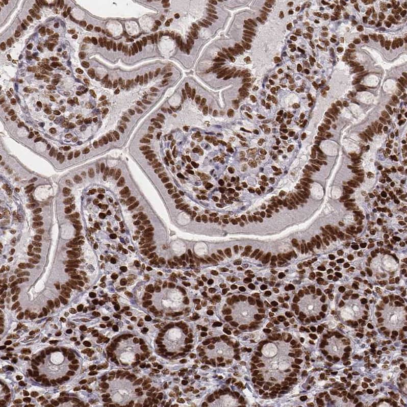 PARP Antibody (CL2220) - Azide and BSA Free Immunohistochemistry-Paraffin: PARP Antibody [NBP3-44461]