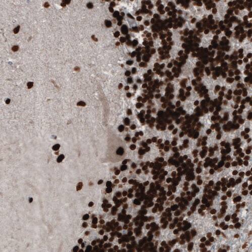 PARP Antibody (CL2209) - Azide and BSA Free Immunohistochemistry-Paraffin: PARP Antibody [NBP3-44462]