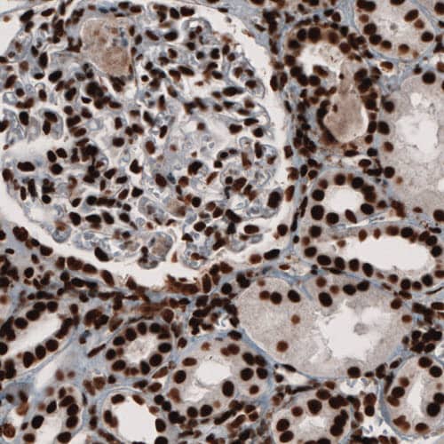 PARP Antibody (CL2209) - Azide and BSA Free Immunohistochemistry-Paraffin: PARP Antibody [NBP3-44462]