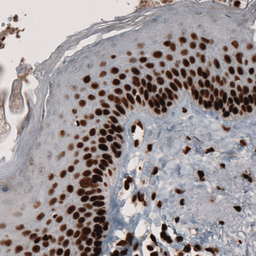 PARP Antibody (CL2209) - Azide and BSA Free Immunohistochemistry-Paraffin: PARP Antibody [NBP3-44462]