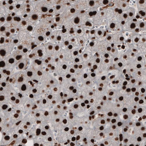 PARP Antibody (CL2209) - Azide and BSA Free Immunohistochemistry-Paraffin: PARP Antibody [NBP3-44462]