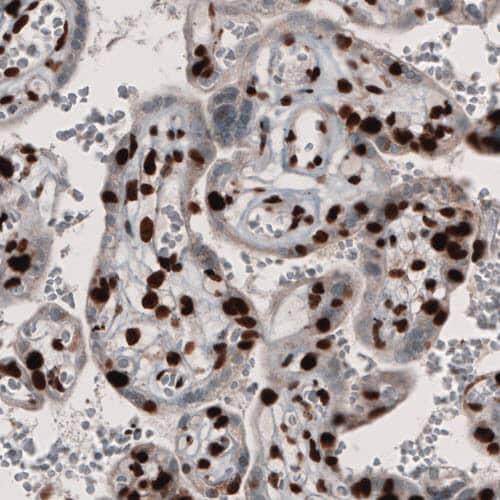 PARP Antibody (CL2209) - Azide and BSA Free Immunohistochemistry-Paraffin: PARP Antibody [NBP3-44462]