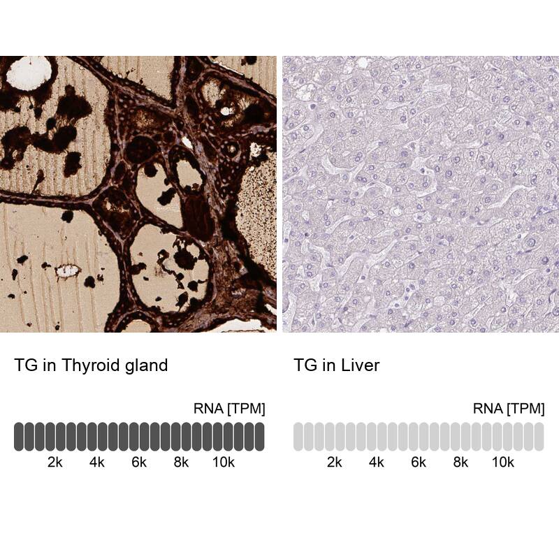 Thyroglobulin Antibody (CL0164) - Azide and BSA Free Immunohistochemistry-Paraffin: Thyroglobulin Antibody [NBP3-44463]