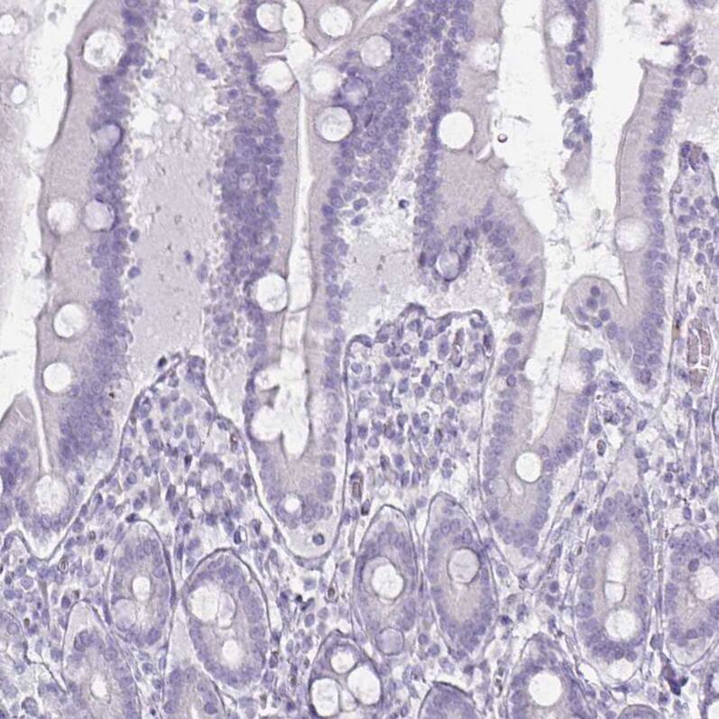Thyroglobulin Antibody (CL0164) - Azide and BSA Free Immunohistochemistry-Paraffin: Thyroglobulin Antibody [NBP3-44463]
