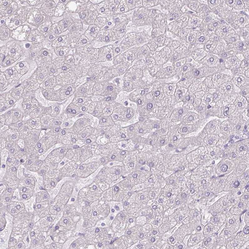 Thyroglobulin Antibody (CL0164) - Azide and BSA Free Immunohistochemistry-Paraffin: Thyroglobulin Antibody [NBP3-44463]