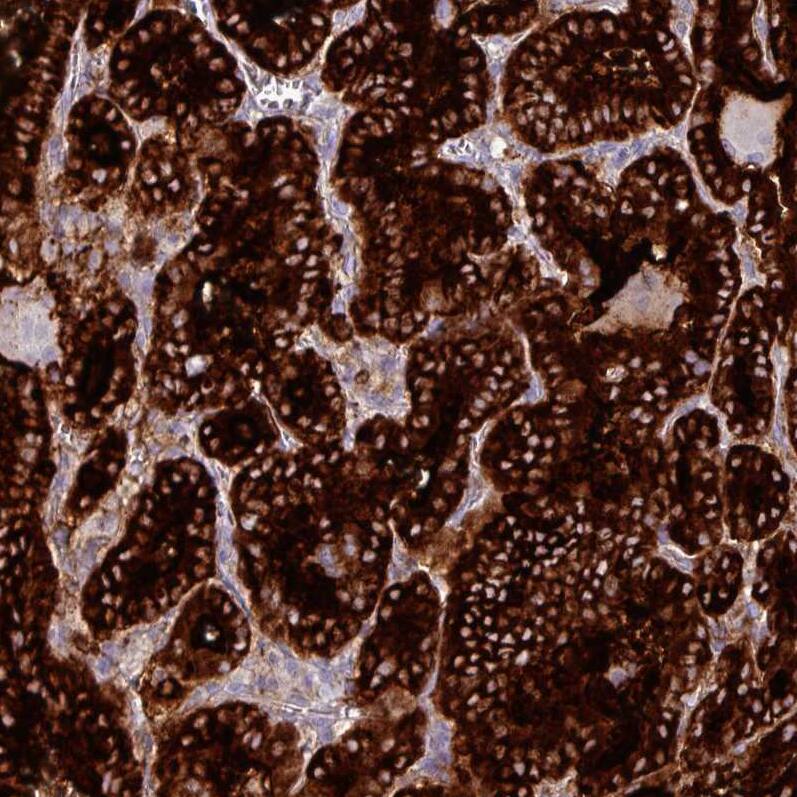 Thyroglobulin Antibody (CL0164) - Azide and BSA Free Immunohistochemistry-Paraffin: Thyroglobulin Antibody [NBP3-44463]