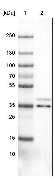 VPS26A Antibody (CL2287) - Azide and BSA Free Western Blot: VPS26A Antibody [NBP3-44464]