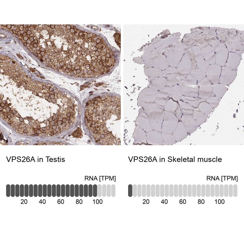 VPS26A Antibody (CL2287) - Azide and BSA Free Immunohistochemistry-Paraffin: VPS26A Antibody [NBP3-44464]