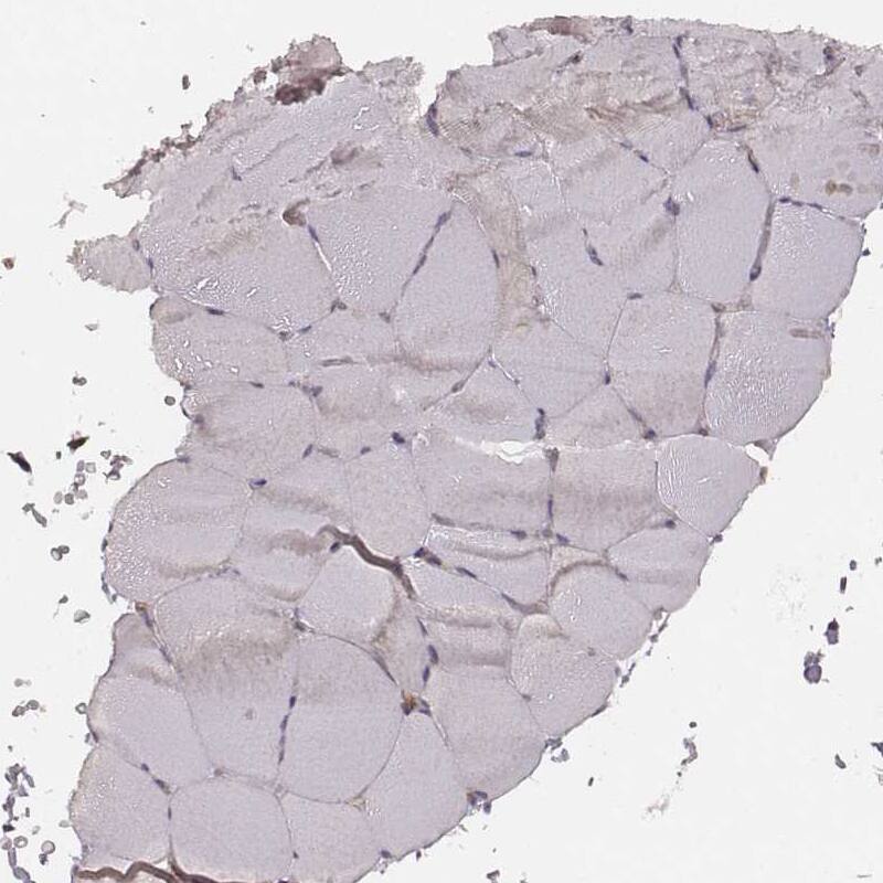 VPS26A Antibody (CL2287) - Azide and BSA Free Immunohistochemistry-Paraffin: VPS26A Antibody [NBP3-44464]