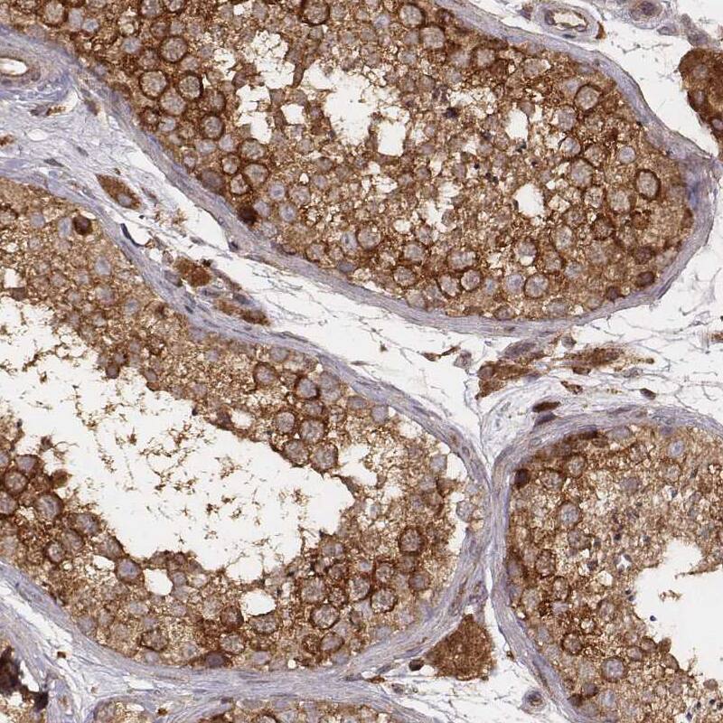VPS26A Antibody (CL2287) - Azide and BSA Free Immunohistochemistry-Paraffin: VPS26A Antibody [NBP3-44464]
