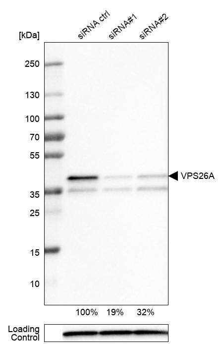 VPS26A Antibody (CL2287) - Azide and BSA Free Western Blot: VPS26A Antibody [NBP3-44464]