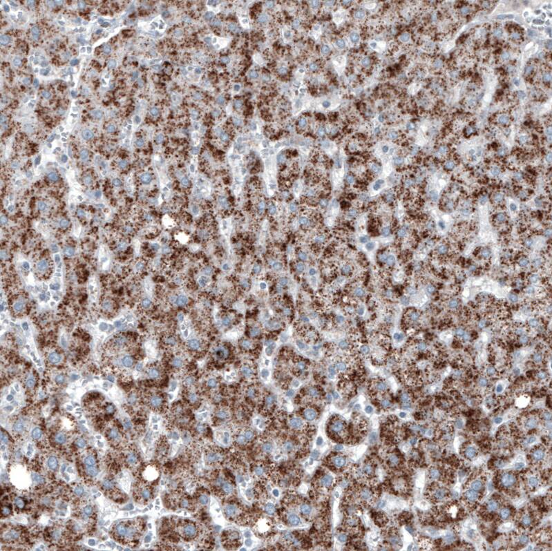 PMP70 Antibody (CL2524) - Azide and BSA Free Immunohistochemistry-Paraffin: PMP70 Antibody [NBP3-44465]
