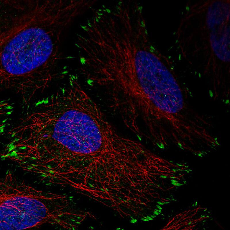 Zyxin Antibody (CL2502) - Azide and BSA Free Immunocytochemistry/ Immunofluorescence: Zyxin Antibody [NBP3-44466]