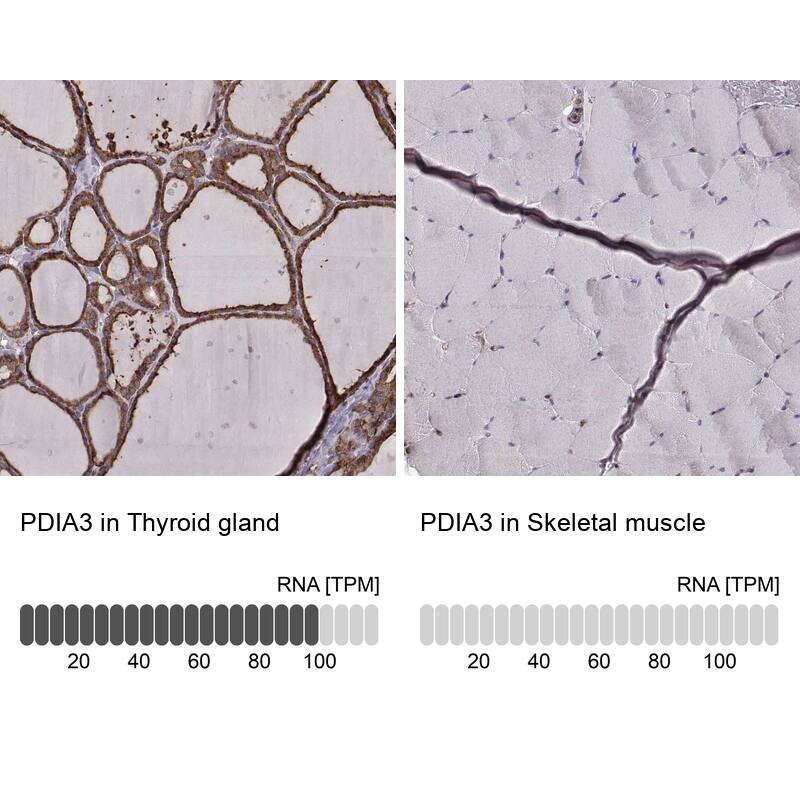 ERp57/PDIA3 Antibody (CL2444) - Azide and BSA Free Immunohistochemistry-Paraffin: ERp57/PDIA3 Antibody [NBP3-44467]