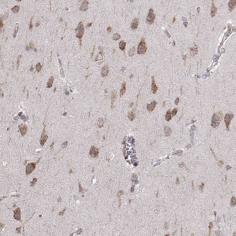 ERp57/PDIA3 Antibody (CL2444) - Azide and BSA Free Immunohistochemistry-Paraffin: ERp57/PDIA3 Antibody [NBP3-44467]
