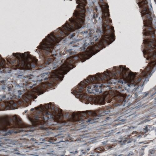 GRASP55 Antibody (CL2522) - Azide and BSA Free Immunohistochemistry-Paraffin: GRASP55 Antibody [NBP3-44470]