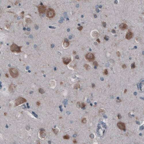 GRASP55 Antibody (CL2522) - Azide and BSA Free Immunohistochemistry-Paraffin: GRASP55 Antibody [NBP3-44470]