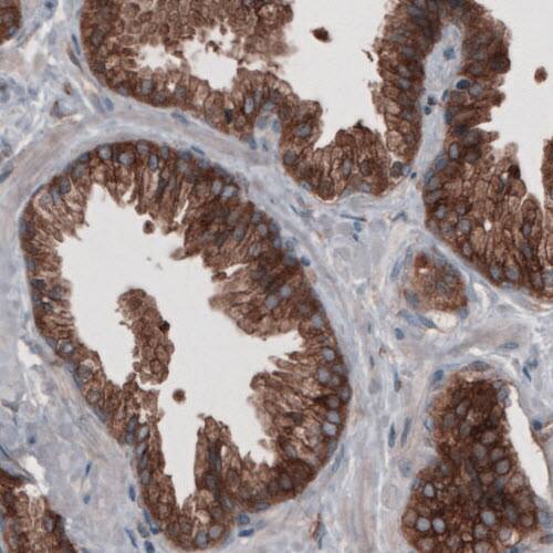 GRASP55 Antibody (CL2522) - Azide and BSA Free Immunohistochemistry-Paraffin: GRASP55 Antibody [NBP3-44470]