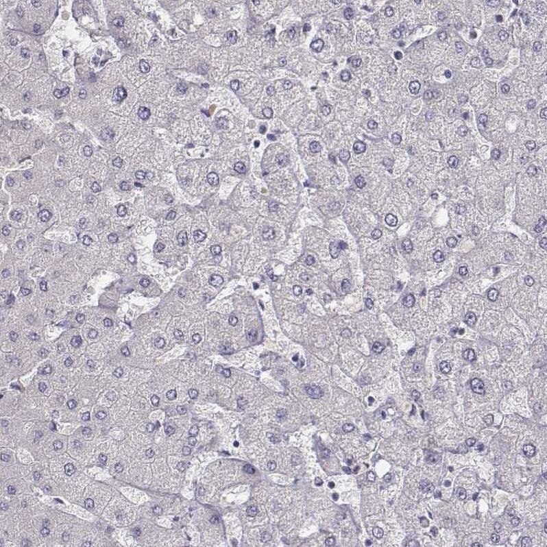 MYH6 Antibody (CL2148) - Azide and BSA Free Immunohistochemistry-Paraffin: MYH6 Antibody [NBP3-44471]