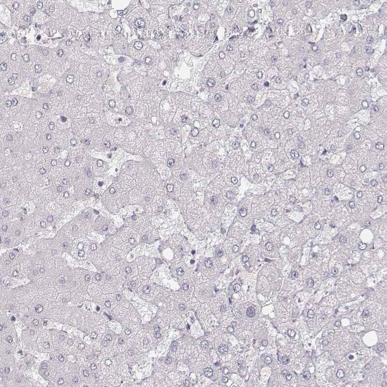 MYH6 Antibody (CL2155) - Azide and BSA Free Immunohistochemistry-Paraffin: MYH6 Antibody [NBP3-44472]