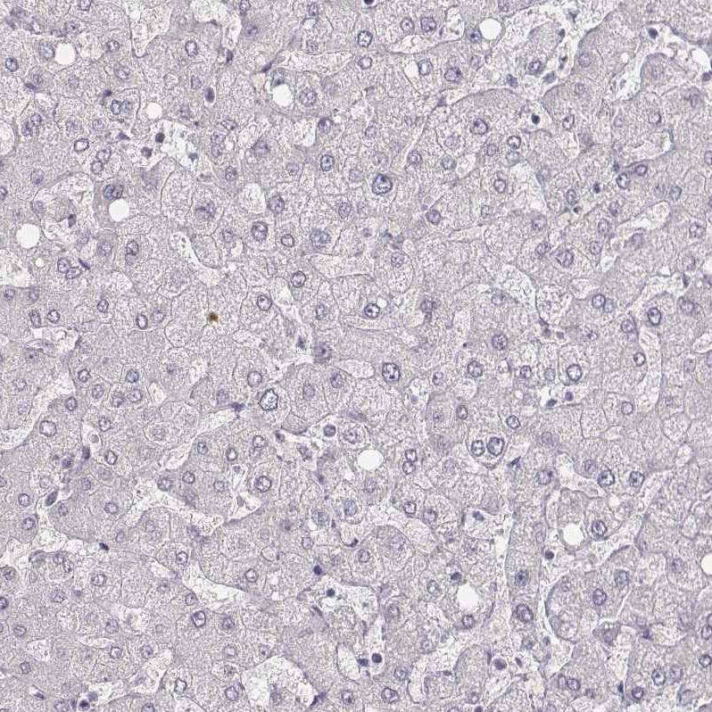 MYH6 Antibody (CL2162) - Azide and BSA Free Immunohistochemistry-Paraffin: MYH6 Antibody [NBP3-44473]