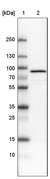 Ezrin Antibody (CL2375) - Azide and BSA Free Western Blot: Ezrin Antibody [NBP3-44474]