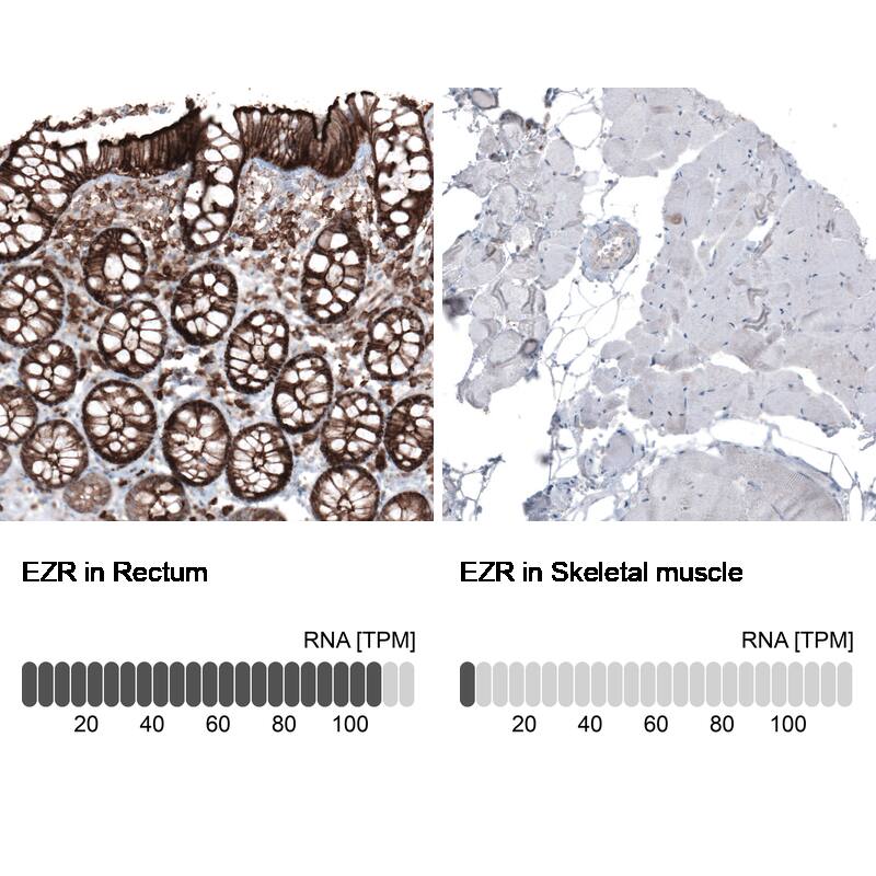 Ezrin Antibody (CL2375) - Azide and BSA Free Immunohistochemistry-Paraffin: Ezrin Antibody [NBP3-44474]