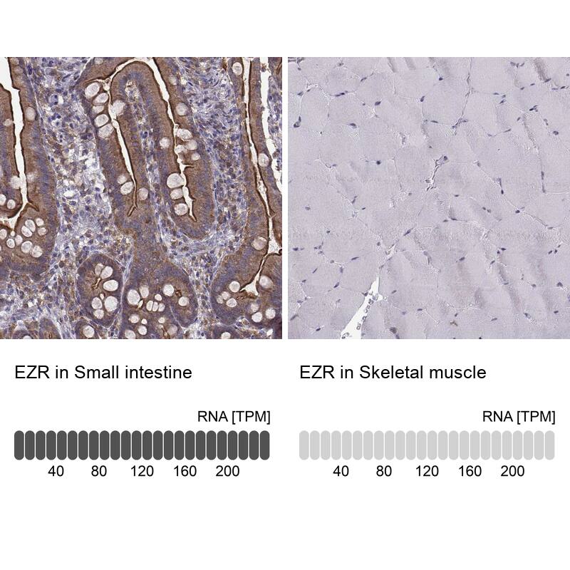 Ezrin Antibody (CL2384) - Azide and BSA Free Immunohistochemistry-Paraffin: Ezrin Antibody [NBP3-44475]