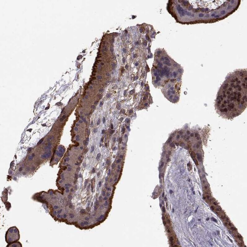 Ezrin Antibody (CL2384) - Azide and BSA Free Immunohistochemistry-Paraffin: Ezrin Antibody [NBP3-44475]