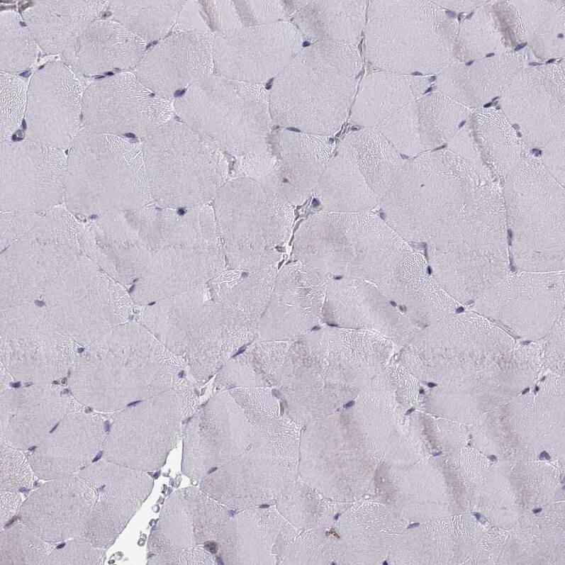 Ezrin Antibody (CL2384) - Azide and BSA Free Immunohistochemistry-Paraffin: Ezrin Antibody [NBP3-44475]