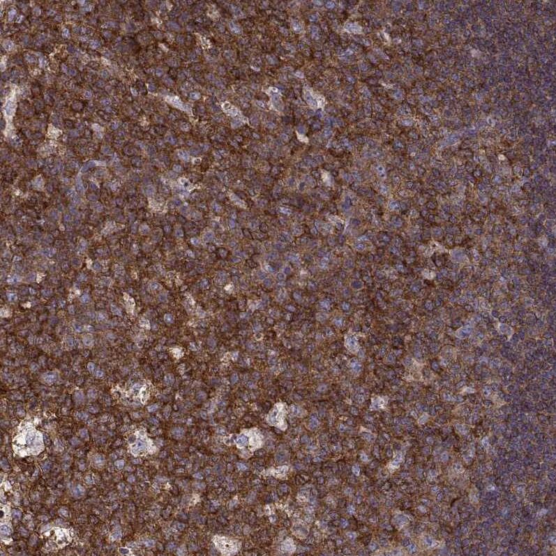 Ezrin Antibody (CL2384) - Azide and BSA Free Immunohistochemistry-Paraffin: Ezrin Antibody [NBP3-44475]