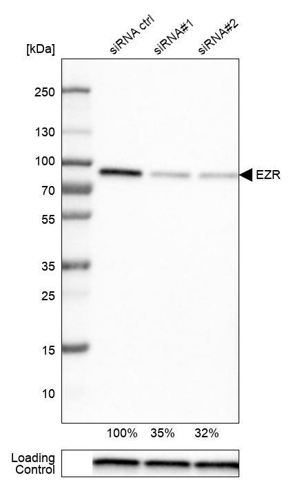 Ezrin Antibody (CL2384) - Azide and BSA Free Western Blot: Ezrin Antibody [NBP3-44475]