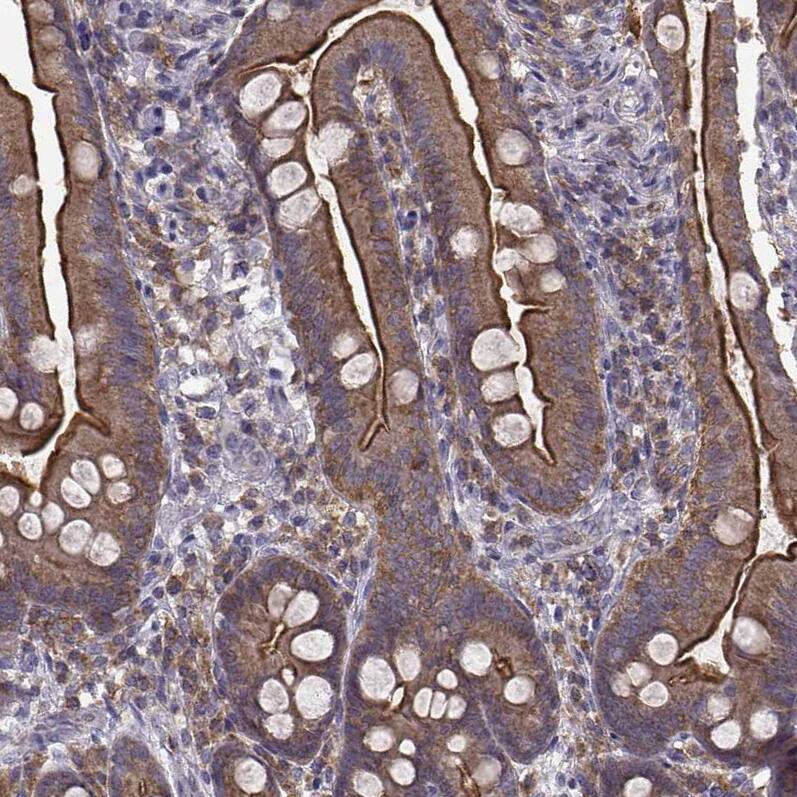 Ezrin Antibody (CL2384) - Azide and BSA Free Immunohistochemistry-Paraffin: Ezrin Antibody [NBP3-44475]