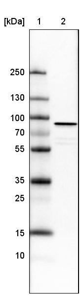 Ezrin Antibody (CL2360) - Azide and BSA Free Western Blot: Ezrin Antibody [NBP3-44476]