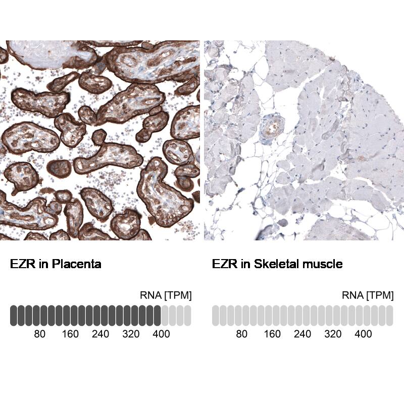 Ezrin Antibody (CL2360) - Azide and BSA Free Immunohistochemistry-Paraffin: Ezrin Antibody [NBP3-44476]