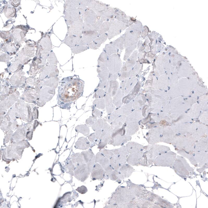 Ezrin Antibody (CL2360) - Azide and BSA Free Immunohistochemistry-Paraffin: Ezrin Antibody [NBP3-44476]