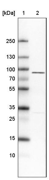 Ezrin Antibody (CL2378) - Azide and BSA Free Western Blot: Ezrin Antibody [NBP3-44477]