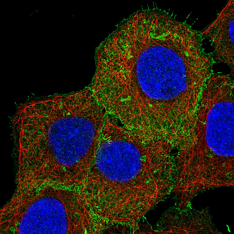 Ezrin Antibody (CL2378) - Azide and BSA Free Immunocytochemistry/ Immunofluorescence: Ezrin Antibody [NBP3-44477]