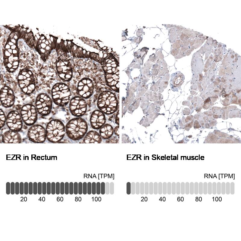 Ezrin Antibody (CL2378) - Azide and BSA Free Immunohistochemistry-Paraffin: Ezrin Antibody [NBP3-44477]