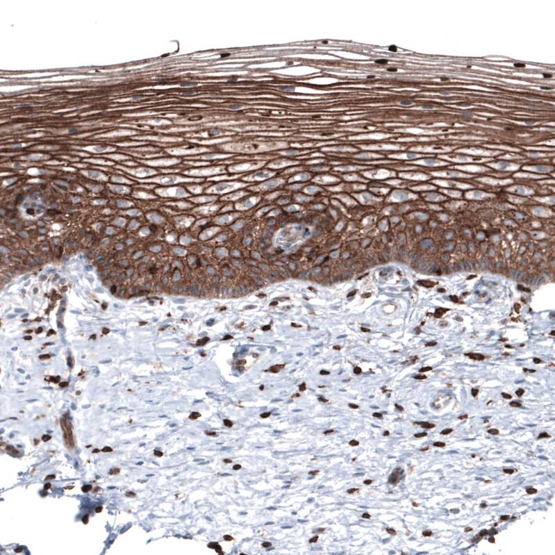 Ezrin Antibody (CL2378) - Azide and BSA Free Immunohistochemistry-Paraffin: Ezrin Antibody [NBP3-44477]