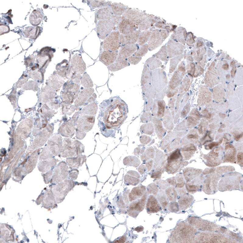 Ezrin Antibody (CL2378) - Azide and BSA Free Immunohistochemistry-Paraffin: Ezrin Antibody [NBP3-44477]