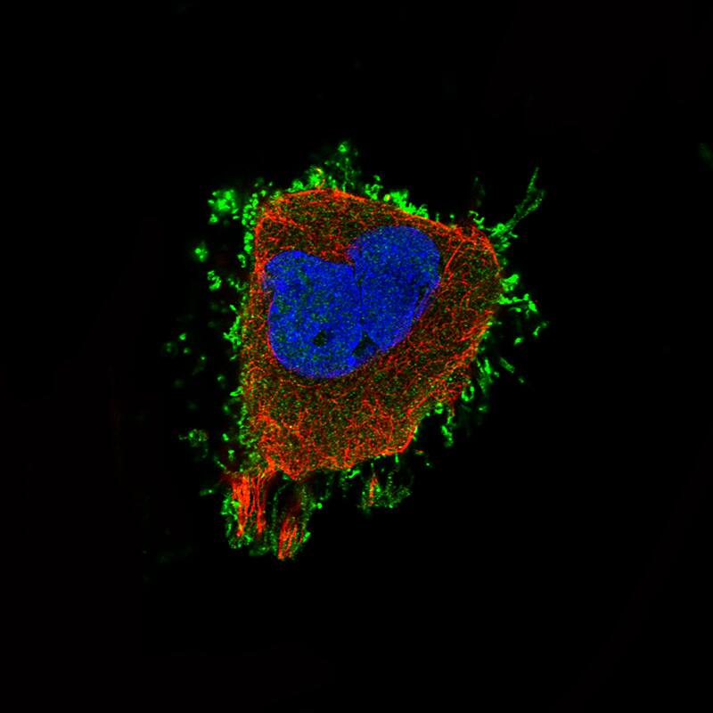 Ezrin Antibody (CL2378) - Azide and BSA Free Immunocytochemistry/ Immunofluorescence: Ezrin Antibody [NBP3-44477]