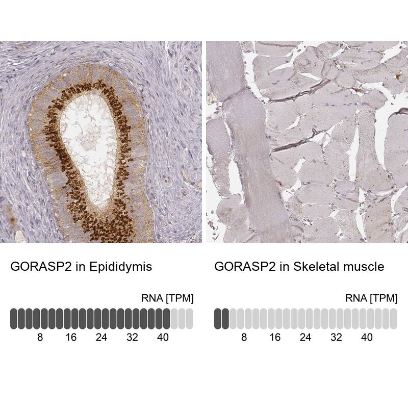GRASP55 Antibody (CL2610) - Azide and BSA Free Immunohistochemistry-Paraffin: GRASP55 Antibody [NBP3-44478]