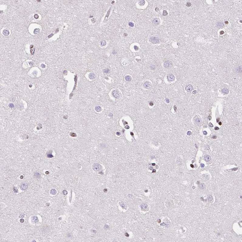 NRSF Antibody (CL0381) - Azide and BSA Free Immunohistochemistry-Paraffin: NRSF Antibody [NBP3-44479]