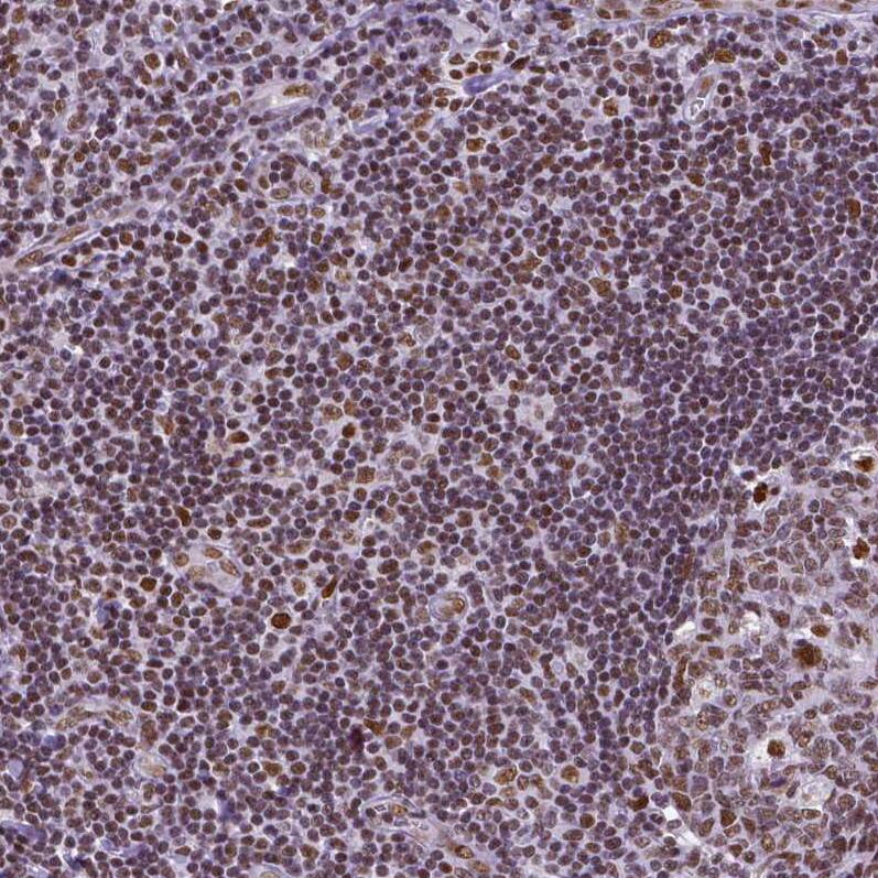 NRSF Antibody (CL0381) - Azide and BSA Free Immunohistochemistry-Paraffin: NRSF Antibody [NBP3-44479]