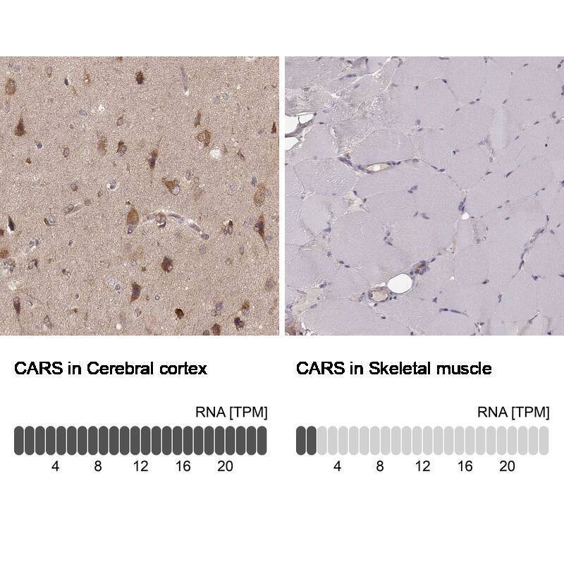 CARS Antibody (CL2302) - Azide and BSA Free Immunohistochemistry-Paraffin: CARS Antibody [NBP3-44480]