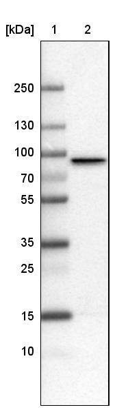 CARS Antibody (CL2302) - Azide and BSA Free Western Blot: CARS Antibody [NBP3-44480]